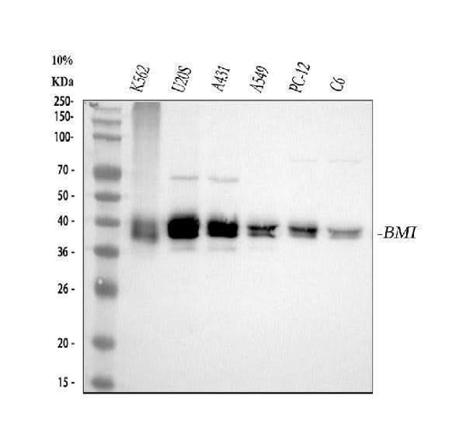 Anti-Bmi1 Rabbit Monoclonal Antibody Boster Bio