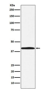 Anti-BGAT Rabbit Monoclonal Antibody Boster Bio