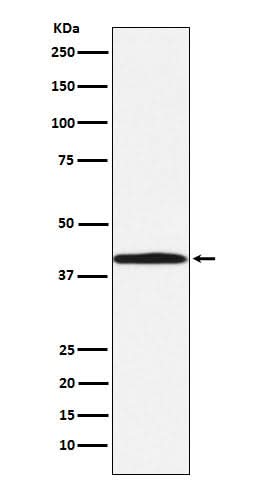 Anti-BGAT Rabbit Monoclonal Antibody Boster Bio