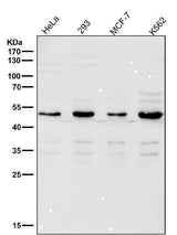 Anti-Lipoprotein lipase LPL Rabbit Monoclonal Antibody Boster Bio