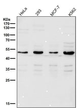 Anti-Lipoprotein lipase LPL Rabbit Monoclonal Antibody Boster Bio