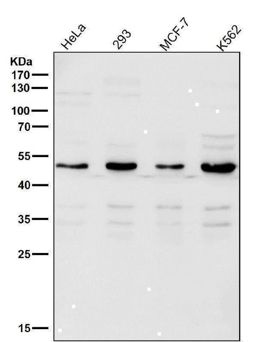 Anti-Lipoprotein lipase LPL Rabbit Monoclonal Antibody Boster Bio