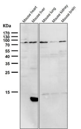 Anti-PI 3 Kinase p85 alpha PIK3R1 Rabbit Monoclonal Antibody Boster Bio