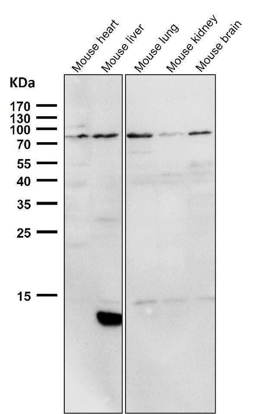 Anti-PI 3 Kinase p85 alpha PIK3R1 Rabbit Monoclonal Antibody Boster Bio