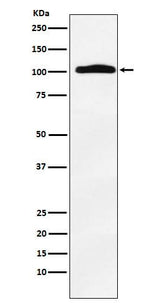 Anti-Thyroid Peroxidase Rabbit Monoclonal Antibody Boster Bio