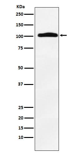 Anti-Thyroid Peroxidase Rabbit Monoclonal Antibody Boster Bio