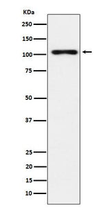 Anti-TPO Monoclonal Antibody Boster Bio