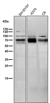 Anti-BACE1/Bace Rabbit Monoclonal Antibody Boster Bio