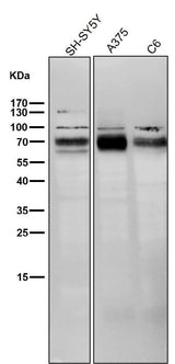 Anti-BACE1/Bace Rabbit Monoclonal Antibody Boster Bio