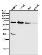 Anti-HDAC2/Histone Deacetylase 2 Rabbit Monoclonal Antibody Boster Bio