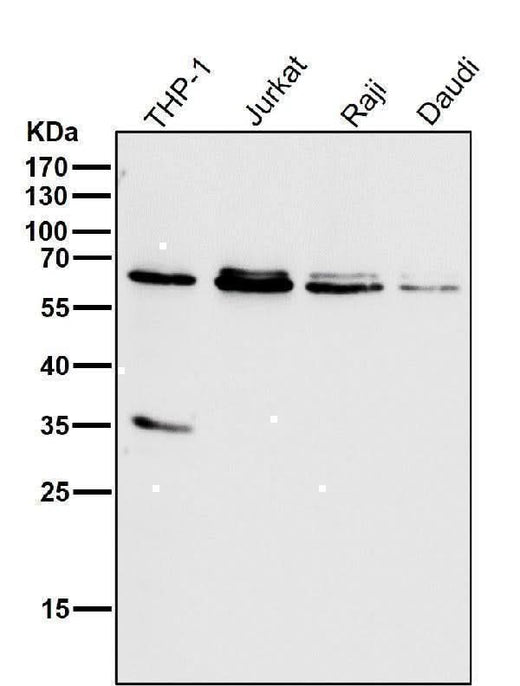 Anti-HDAC2/Histone Deacetylase 2 Rabbit Monoclonal Antibody Boster Bio