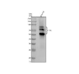 Anti-Tyrosinase Rabbit Monoclonal Antibody Boster Bio