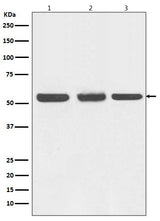 Anti-Beclin 1 BECN1 Monoclonal Antibody Boster Bio
