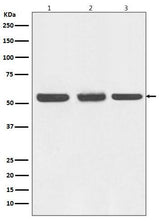 Anti-Beclin 1 BECN1 Monoclonal Antibody Boster Bio