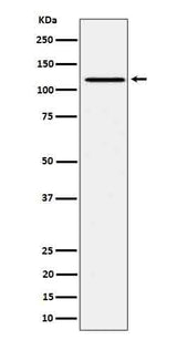 Anti-Phospho-JAK1 (Y1034 + Y1035) Rabbit Monoclonal Antibody Boster Bio