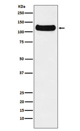 Anti-DDB1 Monoclonal Antibody Boster Bio