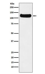 Anti-DDB1 Monoclonal Antibody Boster Bio