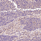 Anti-active + pro Caspase 3 CASP3 Rabbit Monoclonal Antibody Boster Bio