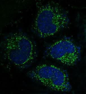 Anti-Caspase-3 CASP3 Rabbit Monoclonal Antibody Boster Bio