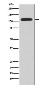 Anti-NFAT2 NFATC1 Rabbit Monoclonal Antibody Boster Bio