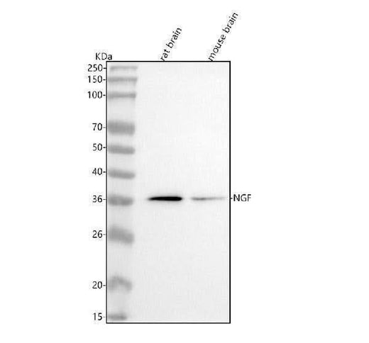 Anti-NGF/Beta Ngf Rabbit Monoclonal Antibody Boster Bio