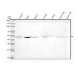 Anti-Tissue Factor Rabbit Monoclonal Antibody Boster Bio