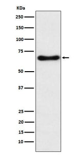 Anti-CYP24A1 Rabbit Monoclonal Antibody Boster Bio
