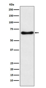 Anti-CYP24A1 Rabbit Monoclonal Antibody Boster Bio