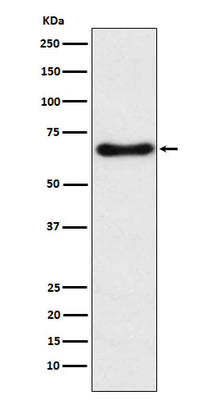 Anti-CYP24A1 Rabbit Monoclonal Antibody Boster Bio