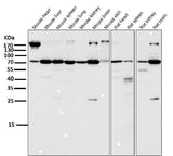 Anti-Atg7 (Apg7) Monoclonal Antibody Boster Bio