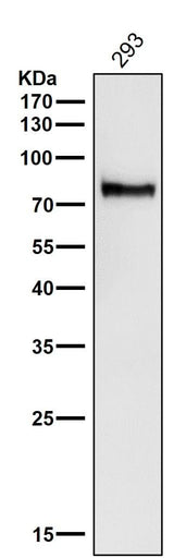 Anti-ATG7/Apg7 Rabbit Monoclonal Antibody Boster Bio