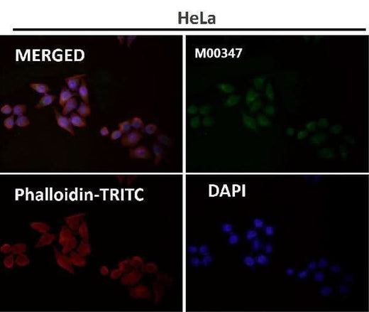 Anti-Rad50 Monoclonal Antibody Boster Bio