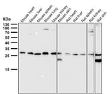 Anti-PDGF B Rabbit Monoclonal Antibody Boster Bio