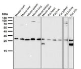 Anti-PDGF B Rabbit Monoclonal Antibody Boster Bio