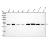 Anti-SOD2 (acetyl K68) Rabbit Monoclonal Antibody Boster Bio
