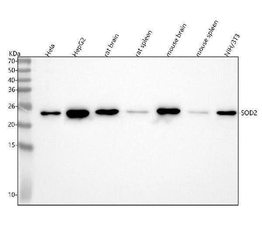Anti-SOD2/Mnsod Rabbit Monoclonal Antibody Boster Bio