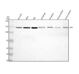 Anti-Leptin Receptor LEPR Rabbit Monoclonal Antibody Boster Bio