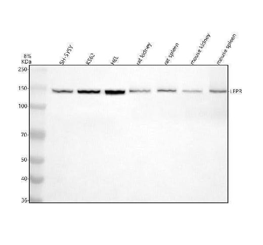 Anti-Leptin Receptor LEPR Rabbit Monoclonal Antibody Boster Bio