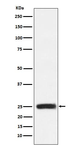 Anti-GRB2 Monoclonal Antibody Boster Bio