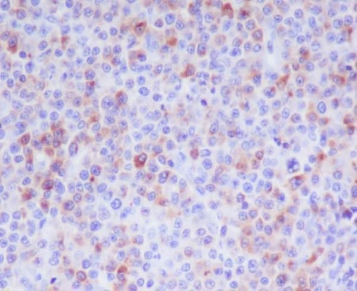 Anti-Granzyme B GZMB Monoclonal Antibody Boster Bio