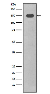 Anti-CD11c ITGAX Rabbit Monoclonal Antibody Boster Bio