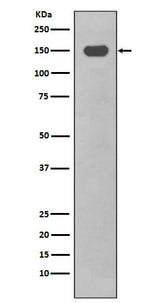 Anti-CD11c ITGAX Rabbit Monoclonal Antibody Boster Bio