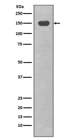 Anti-CD11c ITGAX Rabbit Monoclonal Antibody Boster Bio