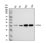 Anti-CDK6 Rabbit Monoclonal Antibody Boster Bio