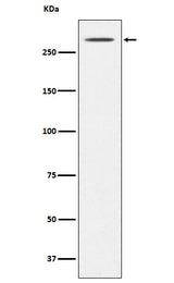 Anti-Thyroglobulin TG Monoclonal Antibody Boster Bio