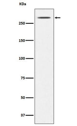 Anti-Thyroglobulin TG Monoclonal Antibody Boster Bio