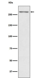 Anti-Thyroglobulin TG Monoclonal Antibody Boster Bio
