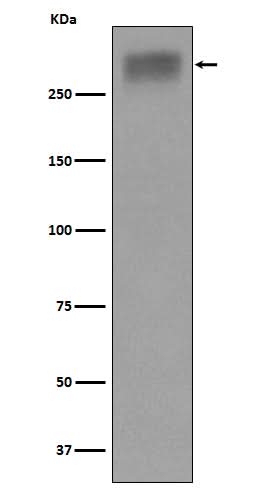 Anti-Thyroglobulin Rabbit Monoclonal Antibody Boster Bio