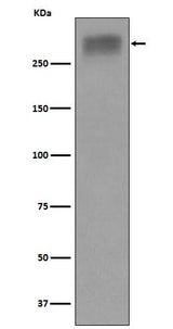 Anti-Thyroglobulin Rabbit Monoclonal Antibody Boster Bio