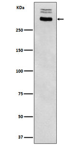 Anti-Thyroglobulin Rabbit Monoclonal Antibody Boster Bio